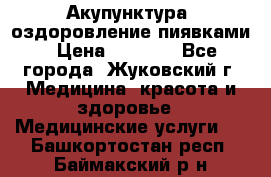 Акупунктура, оздоровление пиявками › Цена ­ 3 000 - Все города, Жуковский г. Медицина, красота и здоровье » Медицинские услуги   . Башкортостан респ.,Баймакский р-н